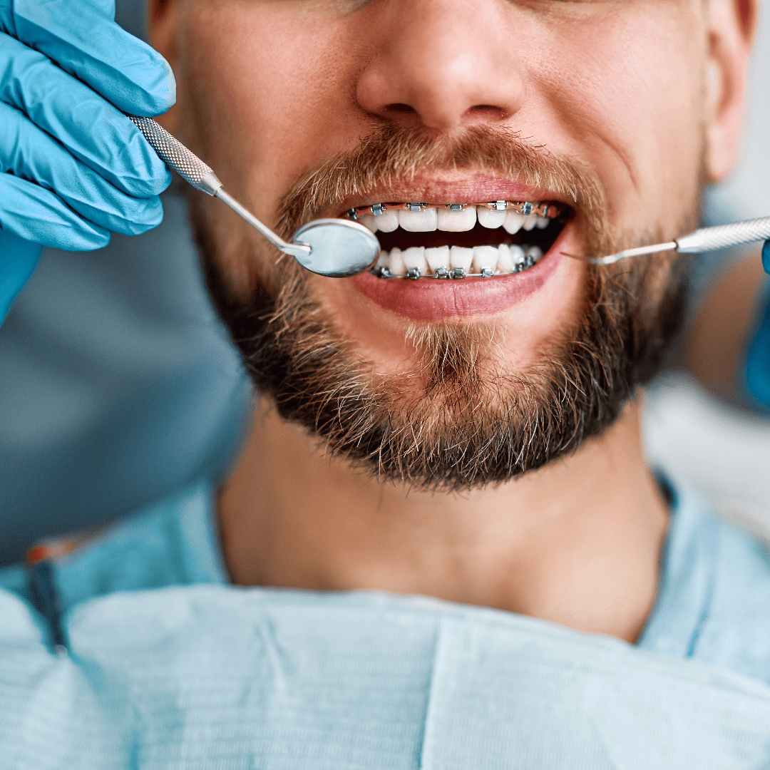 Ortodoncia: La Ciencia de la Alineación Dental y Facial